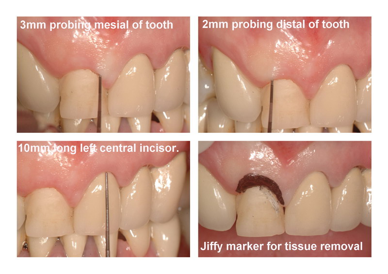 RR patient page 2_resize.jpg